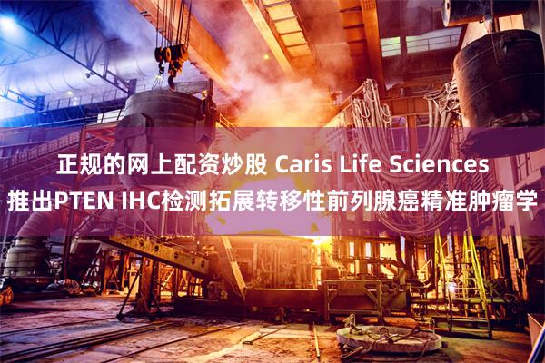 正规的网上配资炒股 Caris Life Sciences推出PTEN IHC检测拓展转移性前列腺癌精准肿瘤学